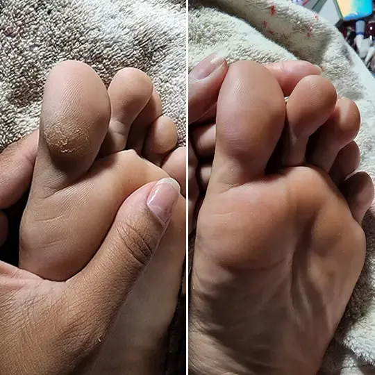 Customer before and after result