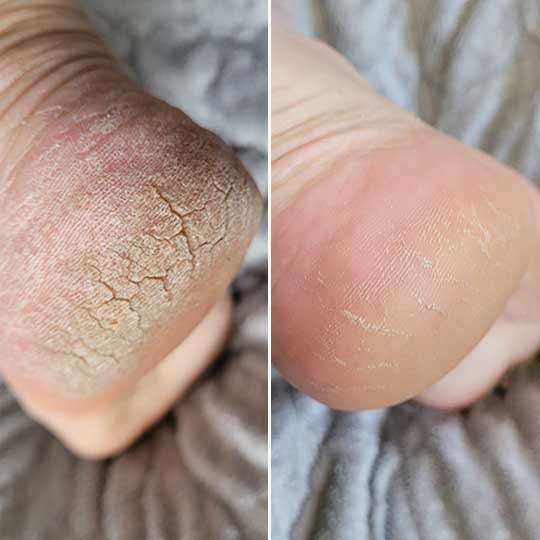 Customer before and after result