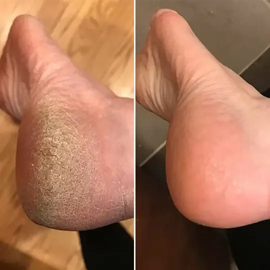 Customer before and after result